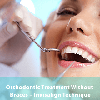 https://dentway.fr/wp-content/uploads/2019/10/braces.png