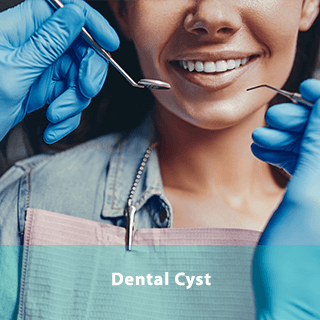 https://dentway.fr/wp-content/uploads/2019/10/dental-cyst.png