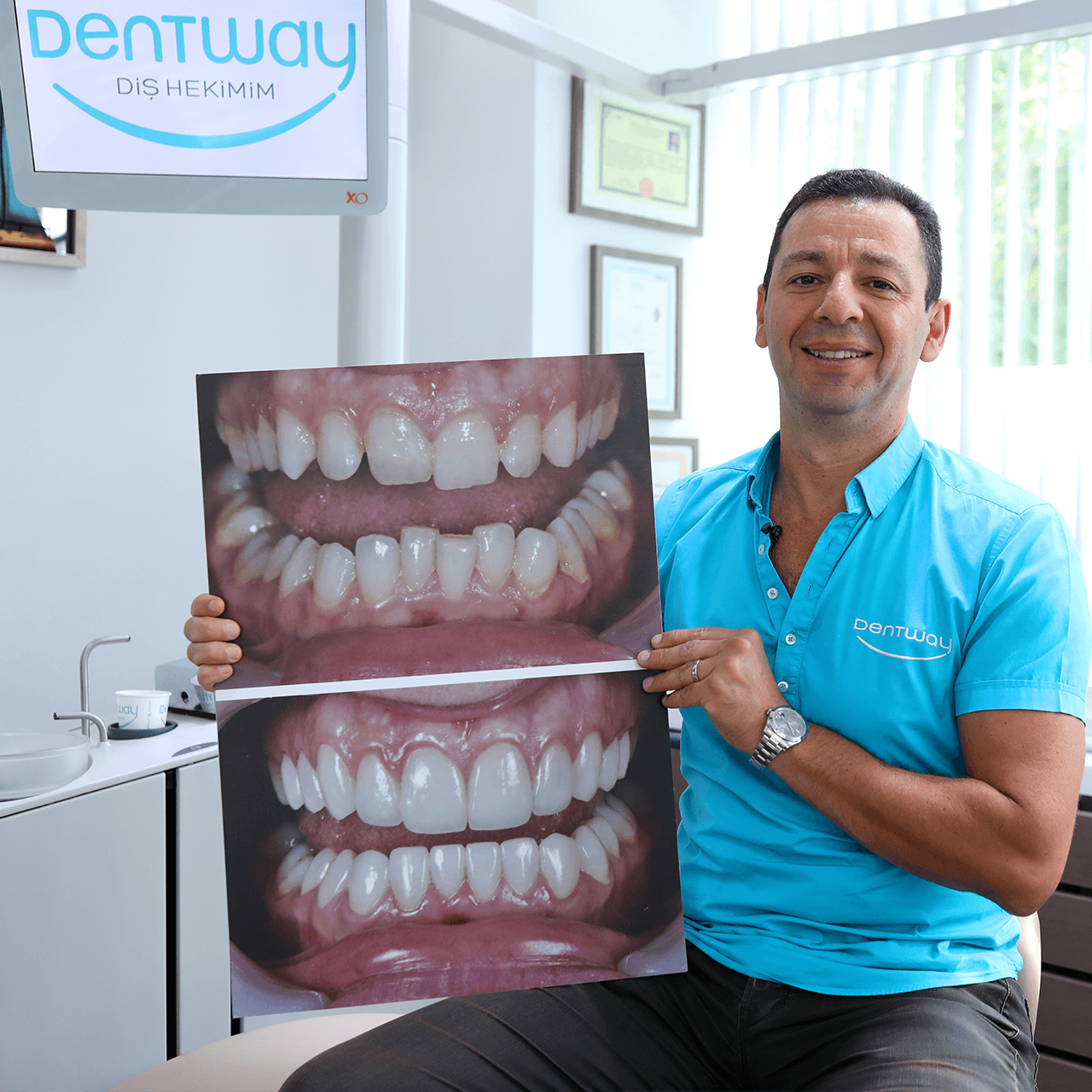 https://dentway.fr/wp-content/uploads/2019/10/dentway-portfolio.png