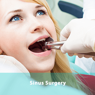 https://dentway.fr/wp-content/uploads/2019/10/sinus.png